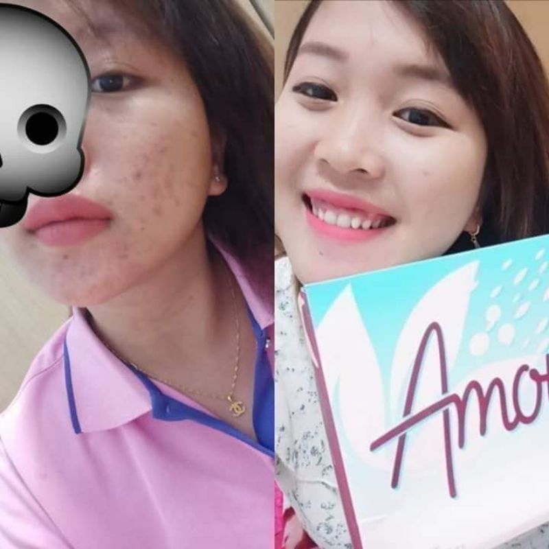 

amotee minuman kolagen