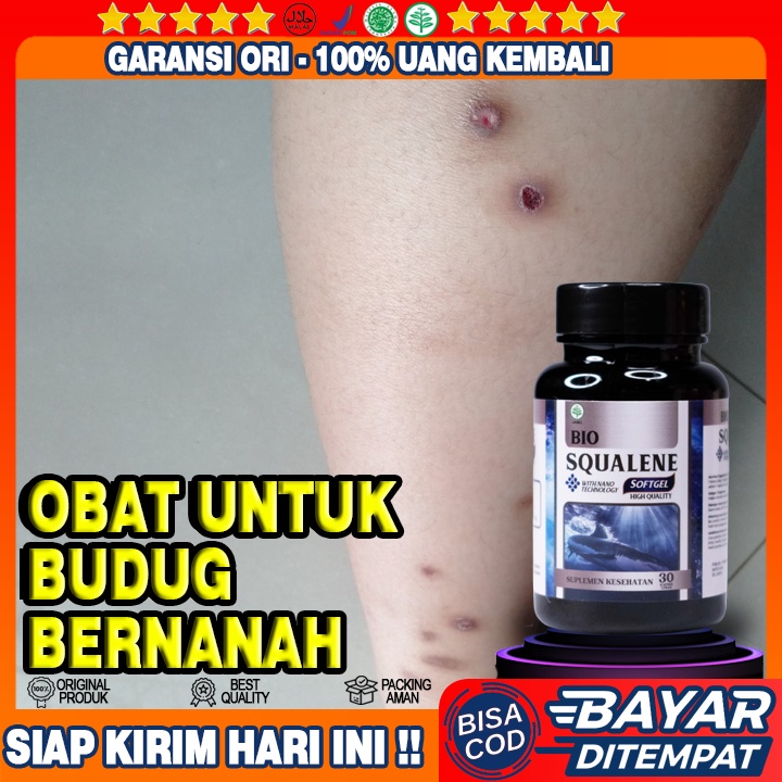 Obat Budug Bernanah - Obat Scabies Manusia - Obat Borok Budug - Obat Budug - Obat Gatal Budug - Obat