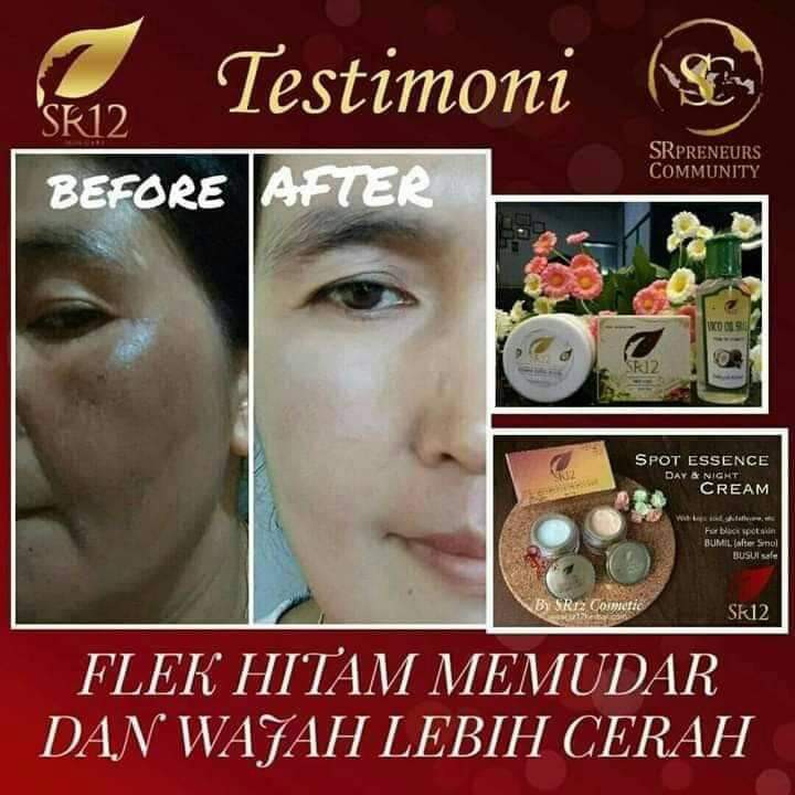 SPOT ESSENCE CREAM SR12 / KRIM SIANG MALAM / FLEK