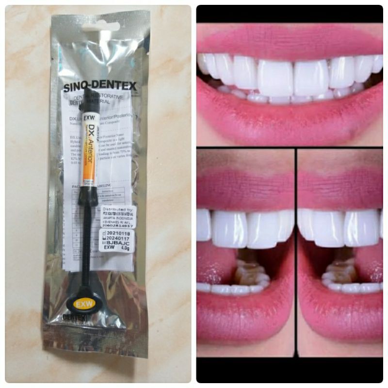 Composite Dentex Anterior XW dan Esthetica EXW Use Veneer Gigi 4gram