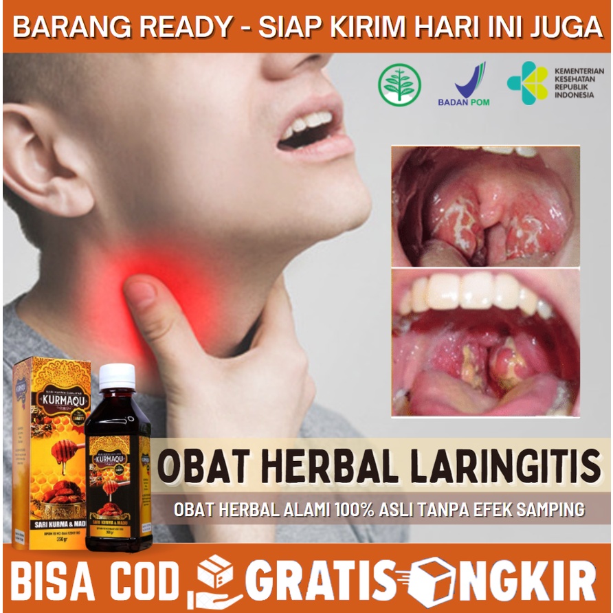 Obat Alami Untuk Radang Tenggorokan, Langiritis, Nyeri Tenggorokan Sebelah, Obat Sakit Tenggorokan A