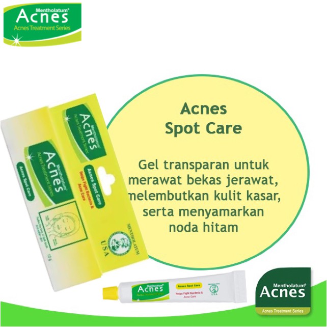 [BPOM] Acnes Spot Care 12gr / Krim Jerawat / Anti Jerawat / Acne Care Treatment / MY MOM