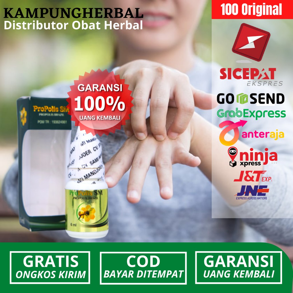 Obat Herbal Untuk Mengobati Kutu Air Di Tangan_Kutut Air Di Kaki_Gatal Gatal_Infeksi_Propolis SM