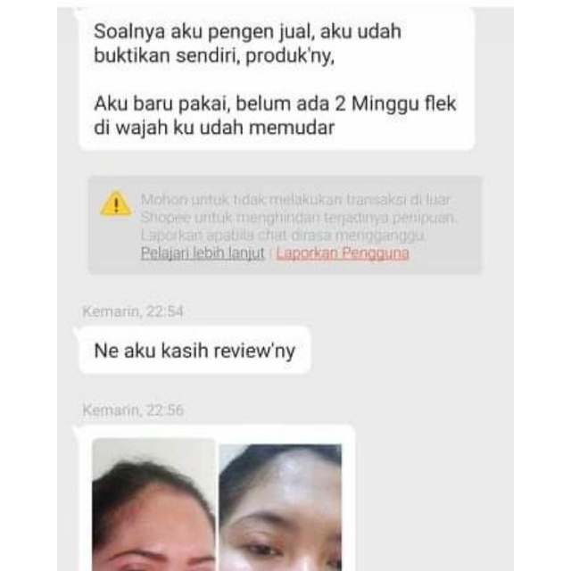 SALEP FLEK AMPUH || SALEP FLEK NIGHT || SALEP FLEK HITAM || SALEP MELASMA || CREAM FLEK || SALEP FLEK MEMBANDEL