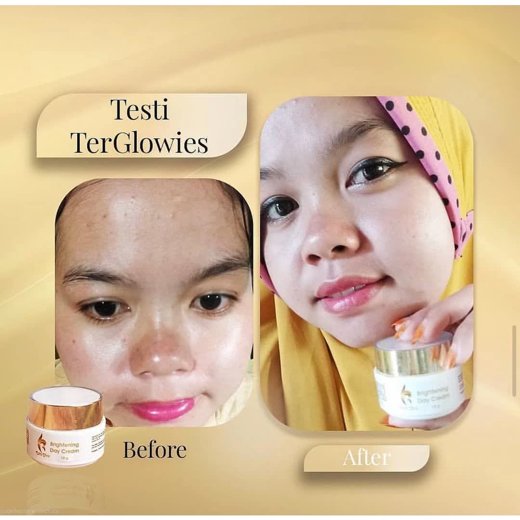 Ratu Glow Night Cream Krim Malam Perawatan Penghilang Jerawat Dan Bekas Jerawat Pelembab Kulit Wajah Anti Acne Atasi Komedo Kusam