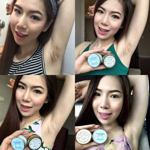 

❇️Underarm Cupkace, ✔️ Pemutih Ketiak BPOM ☑️