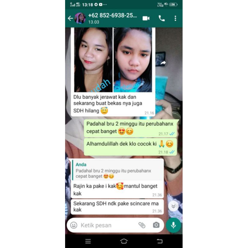 COD paket body serum dan sabun kedas beauty