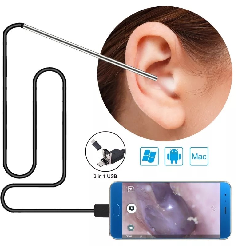 Kamera Pembersih Telinga Anak USB Camera Ear Cleaning Endoscope i95