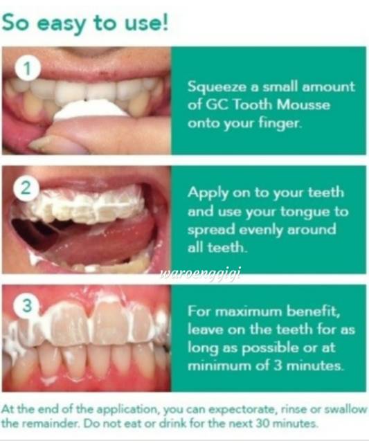 GC Tooth Mousse Non Fluoride (Bisa untuk BALITA) / GC Toothmousse / GC Tooth Mouse