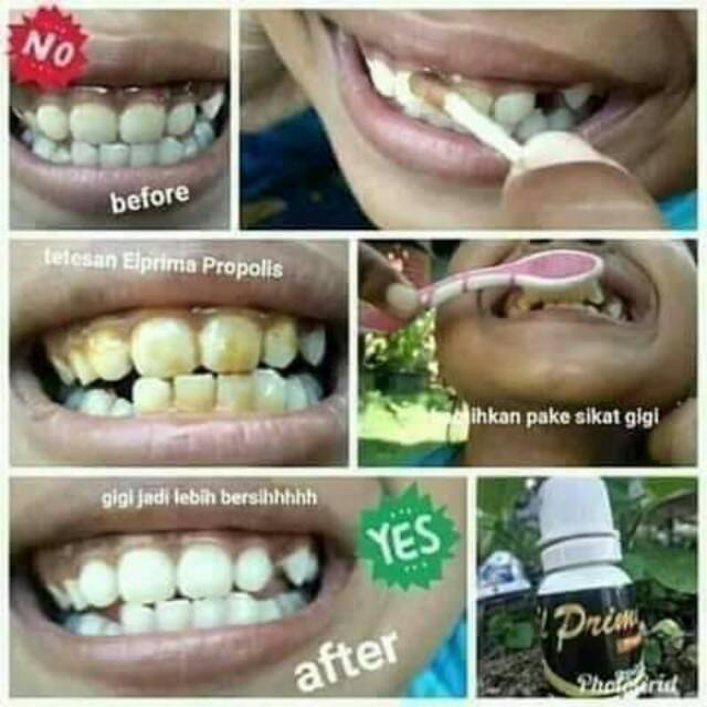 El prima propolis MSI original