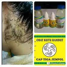 MANJUR Minyak rambut OBAT KUTU TERAMPUH AMAN Semua Usia Herbal Alami Tradisional BONUS SeritsowerCAP