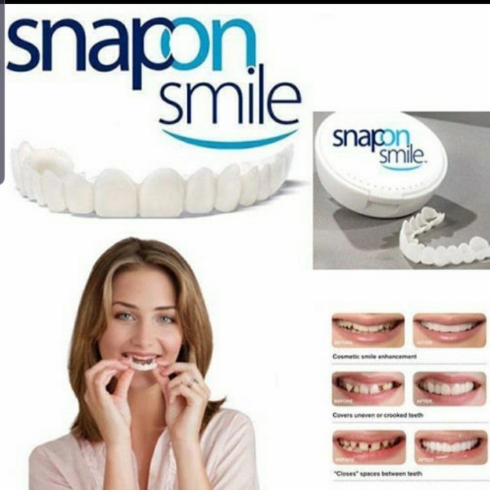 TERBARU SNAP ON SMILE PERFECT SMILE SNAP ON SMILE GIGI PALSU SNAP ON INSTAN 