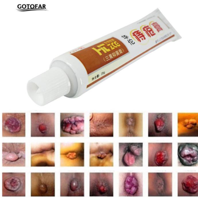 Salep Wasir Ambeyen Ambeien BAB Ampuh Asli Cina HUATUO ZHICHUANG GAO