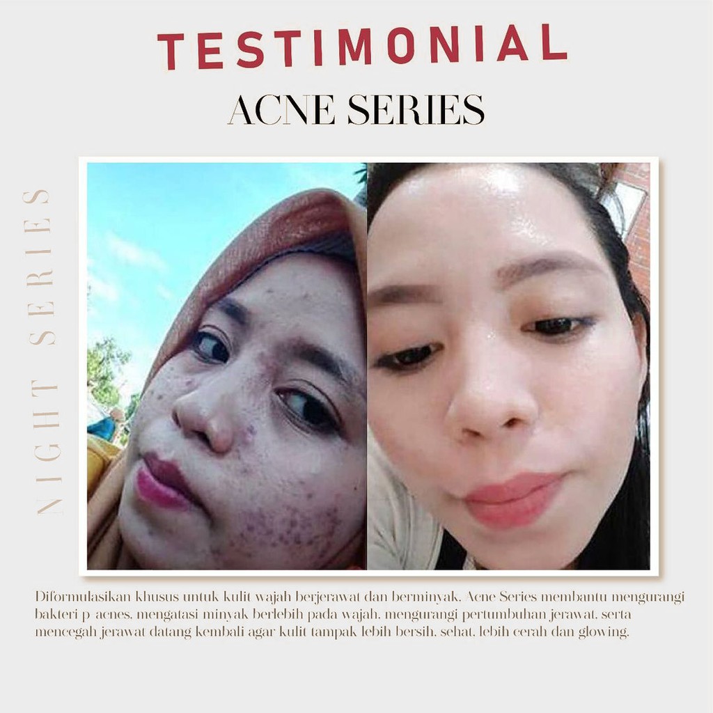 MS GLOW PAKET WAJAH