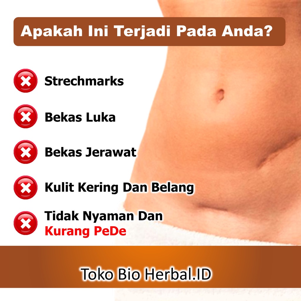 Penghilang Bekas Jerawat Dan Luka Obat Strechmark Paling Ampuh B8Q