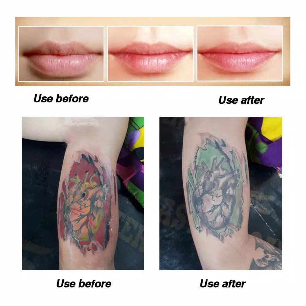 Fougera Krim aftercare BB Glow Sulam Alis Sulam Bibir Tatto