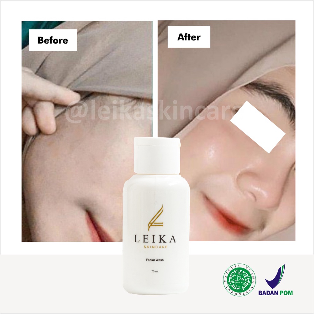 Sabun Wajah! Sabun Pelembab Kulit Wajah Kering Asli 100% BPOM Pelembab Wajah Kusam Berjerawat Jadi Putih Glowing Halal Facial Wash Leika Skincare  70ml Pelembab Wajah Resmi BPOM