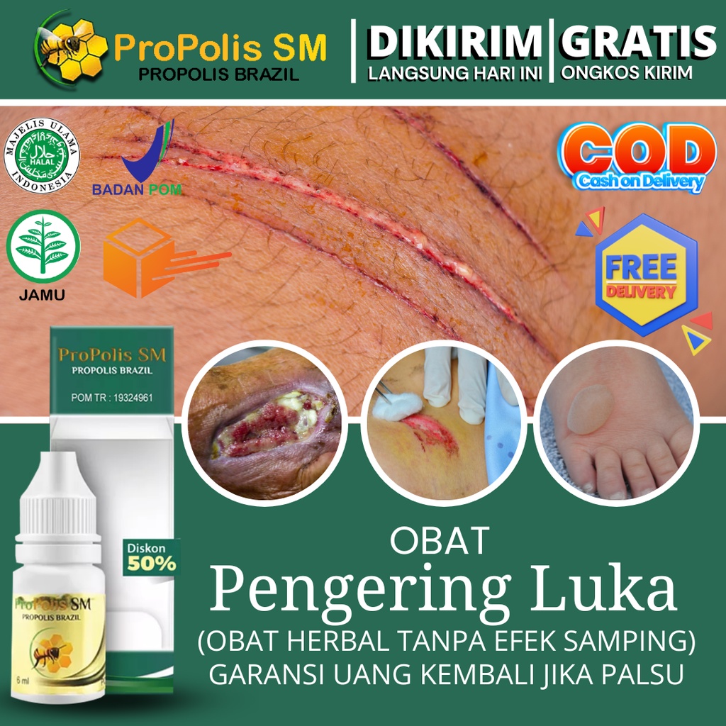 Jual Obat Pengering Luka Basah, Diabetes Basah, Bakar, Jahitan, Sunat, Lecet, Bernanah, Infeksi