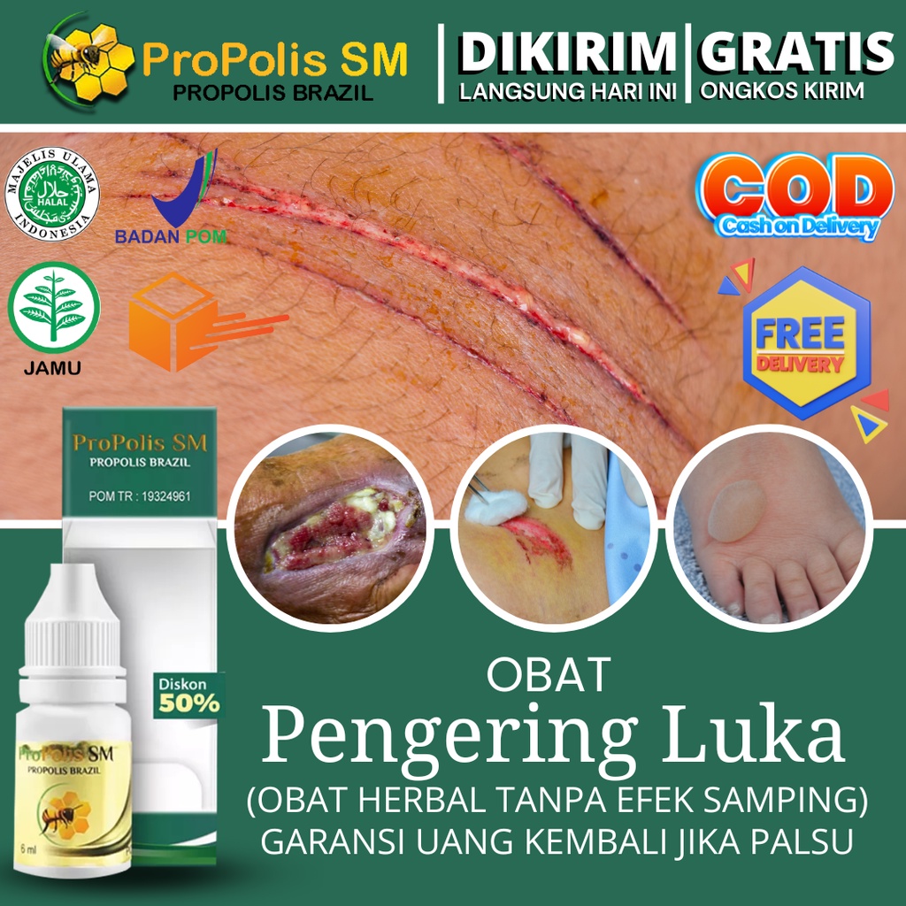 Jual Obat Pengering Luka Basah Diabetes Basah Bakar Jahitan Sunat Lecet Bernanah Infeksi 3450