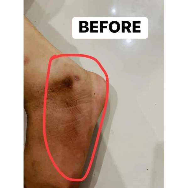 Erfast Neck cream & Dark Skin area