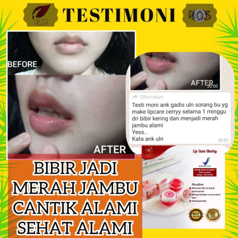 Lip Care Sr12 || Pelembab Bibir || Mengembalikan Warna Alami Bibir || Bibir Merah Alami