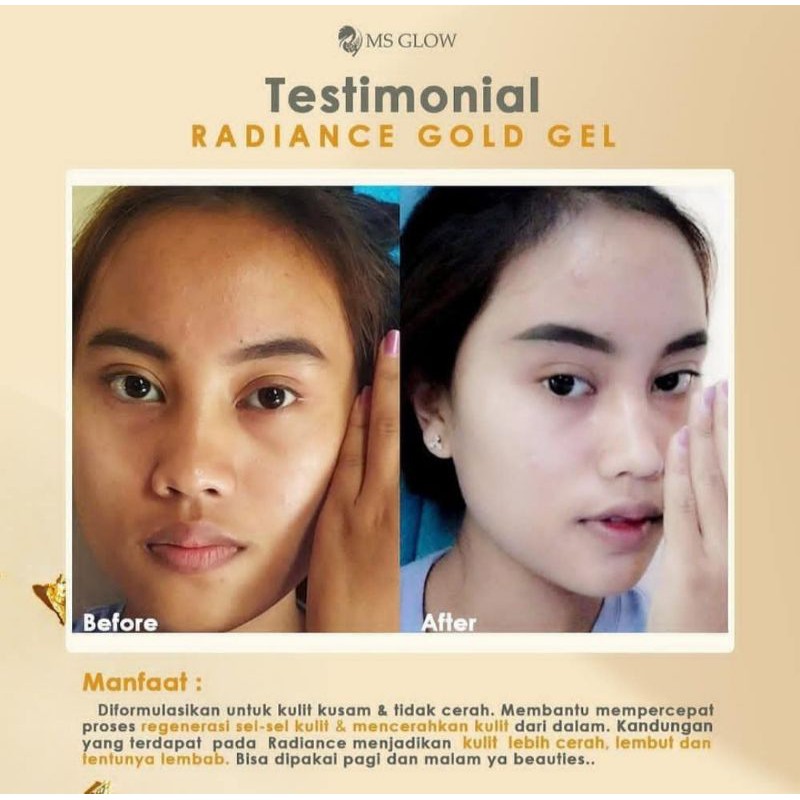 Radiance Gold Gel Ms Glow Original JEL Perawatan Wajah glowing
