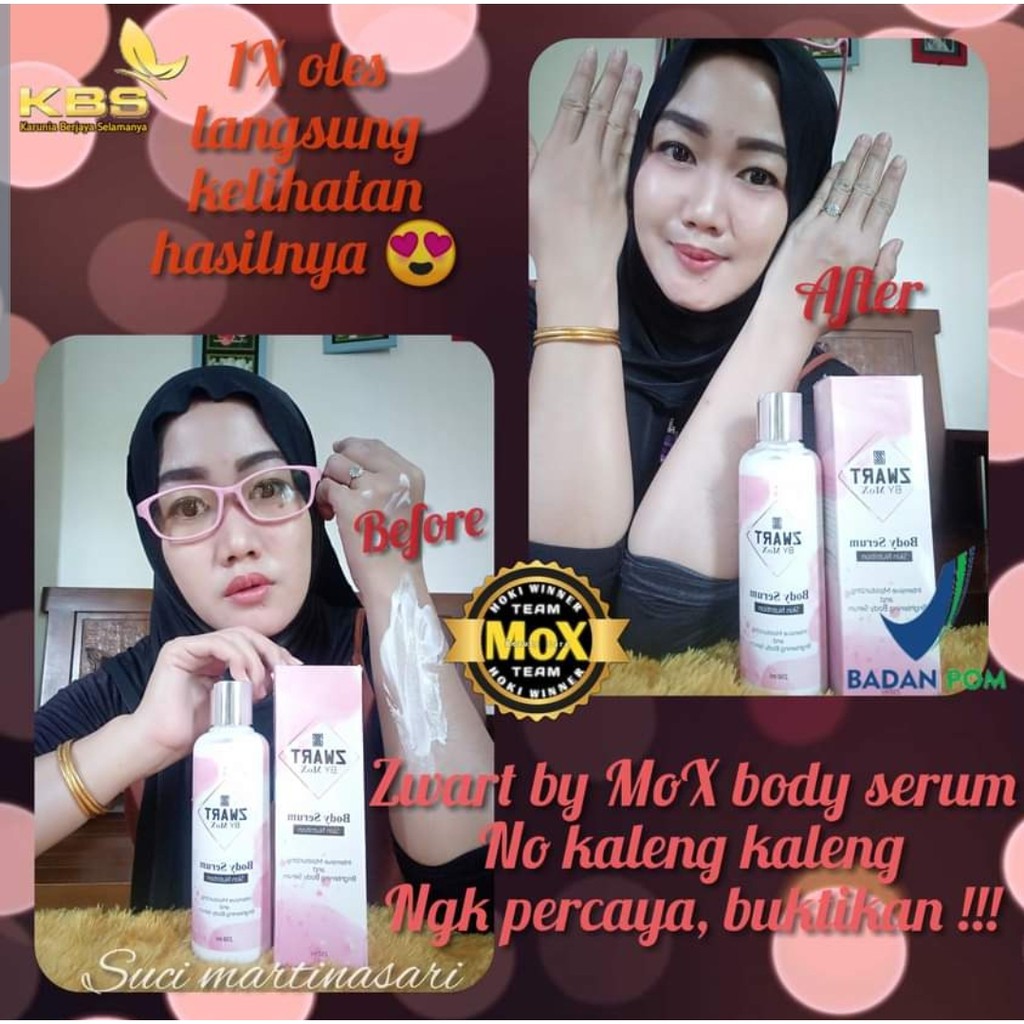Body Serum Zwart by MoX mencerahkan kulit