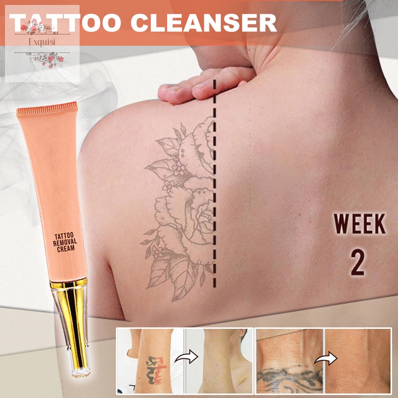 Tattoo Removal Cream Painless Remove Tattoo Ink Remover Without Scarring No Hurt Safe Gentle Shopee Indonesia