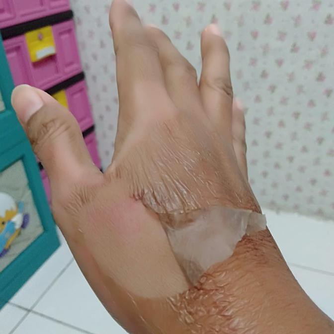 Cantik Tca Peeling 20% | Peeling Cair 100Ml - Bibit Pemutih Kulit Badan Tubuh Diskon