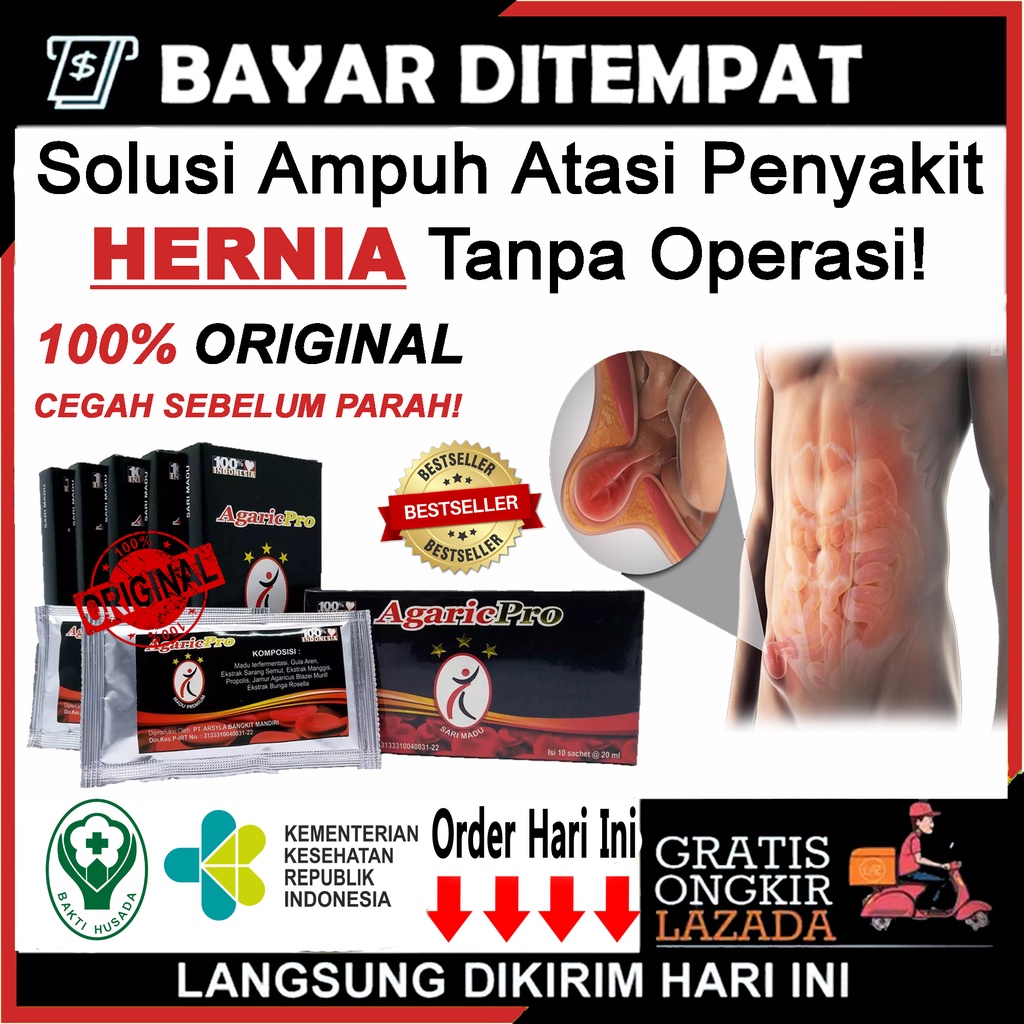 Jual Obat Hernia Tanpa Operasi Obat Hernia Paling Ampuh Obat Hernia