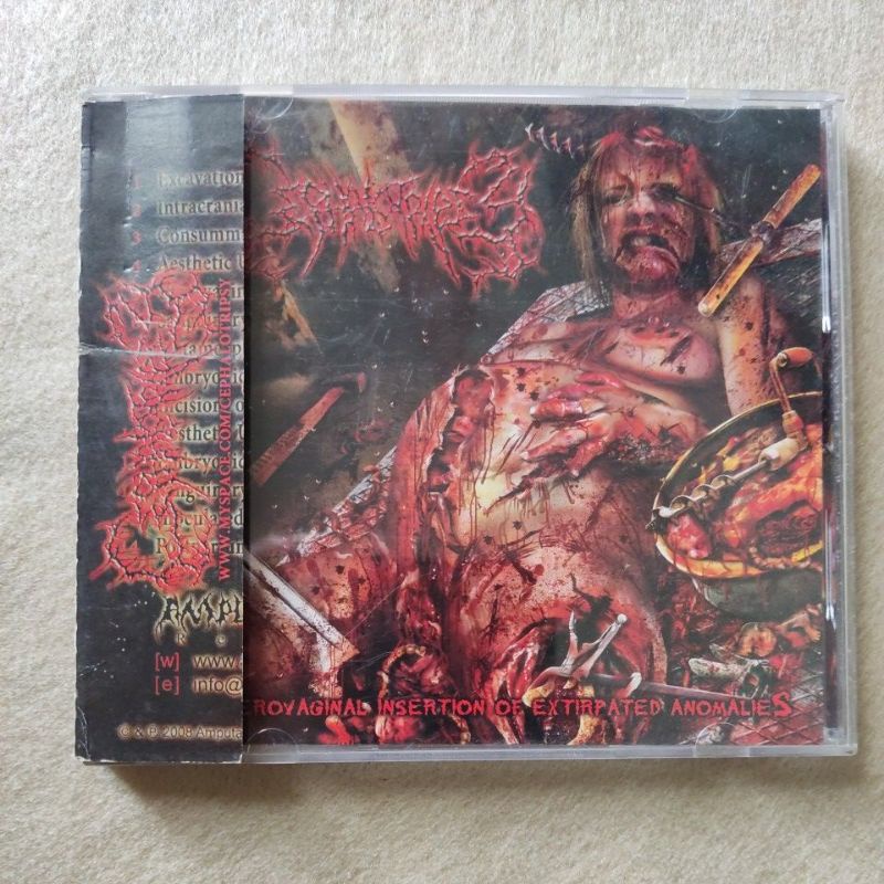 CD Cephalotripsy -Uterovaginal insertion. Import