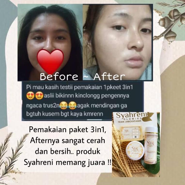 B0I4 BISA () SYAHRENI GLOWING PAKET 3in1 / T SYR GLOWING PAKET 3in1 / T / ALL DAY CREAM ORIGINAL