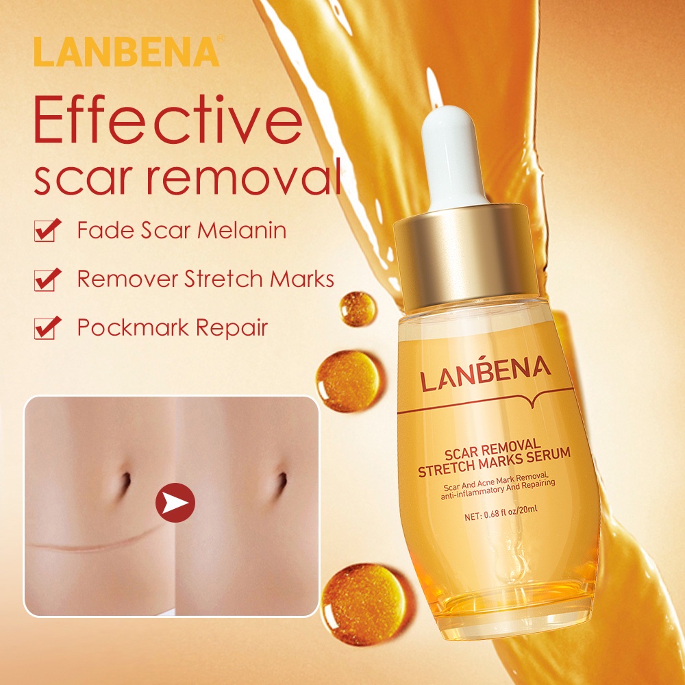 LANBENA SCAR REMOVAL STRETCH MARKS SERUM Penghilang Bekas Luka Stretch Mark