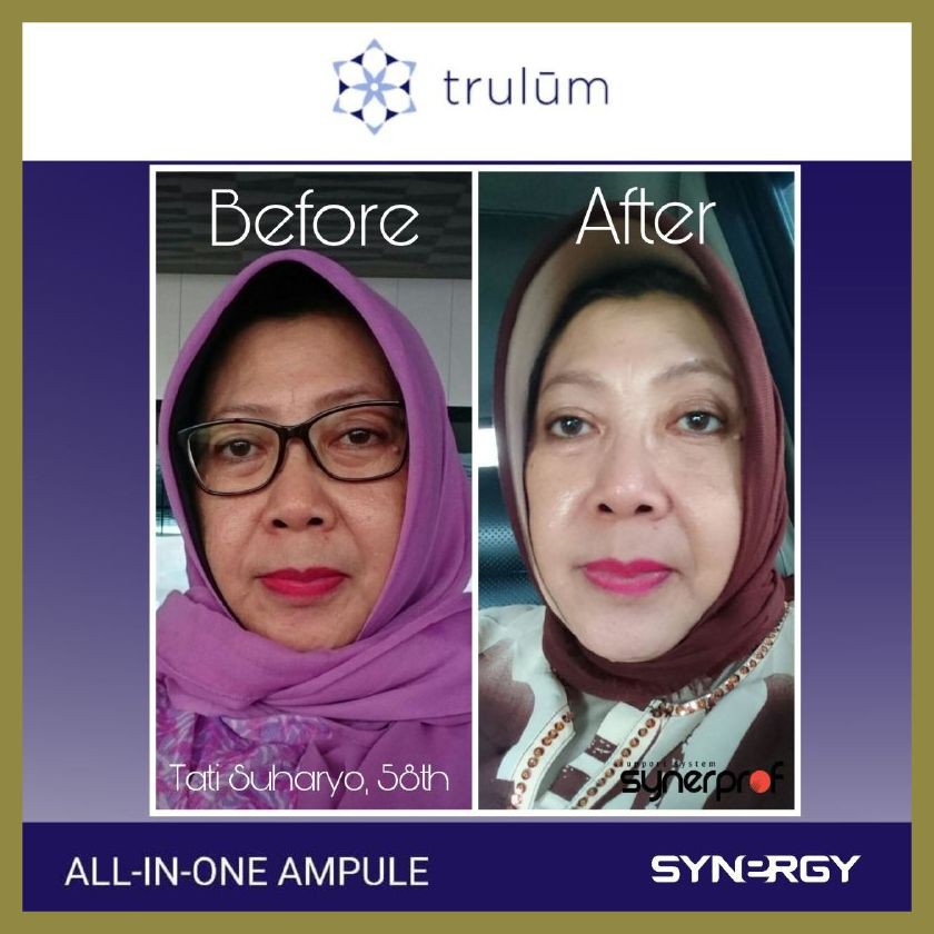 Penghilang Jerawat Dan Bekas Jerawat | Penghilang Bopeng Bekas Jerawat