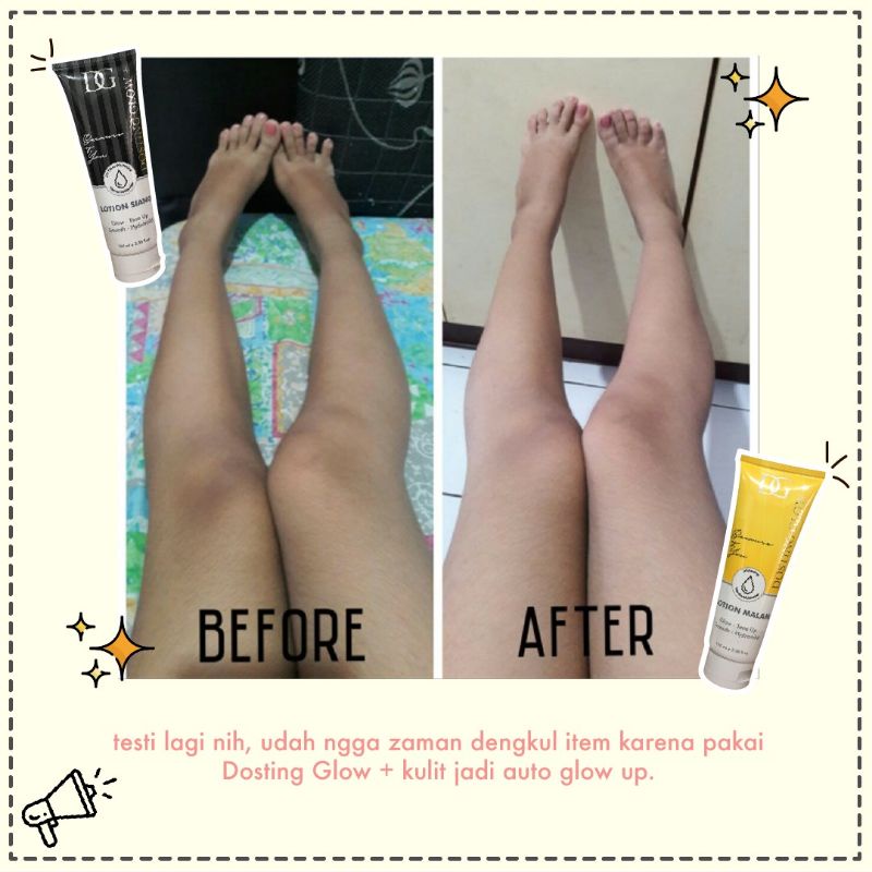 ❤ RATU ❤ Dosting Glow + Hand Body Lotion Whitening Tone Up | Lotion Siang | Lotion Malam | Sabun | Body Scrub | Stretchmark Cream