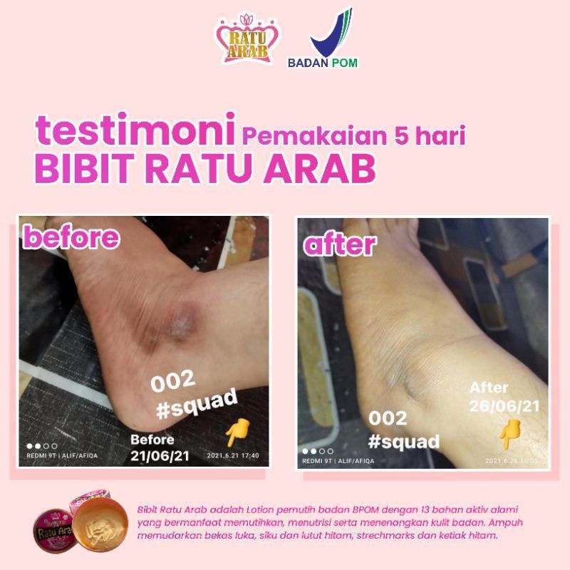 Bibit Ratu Arab Lotion Pemutih