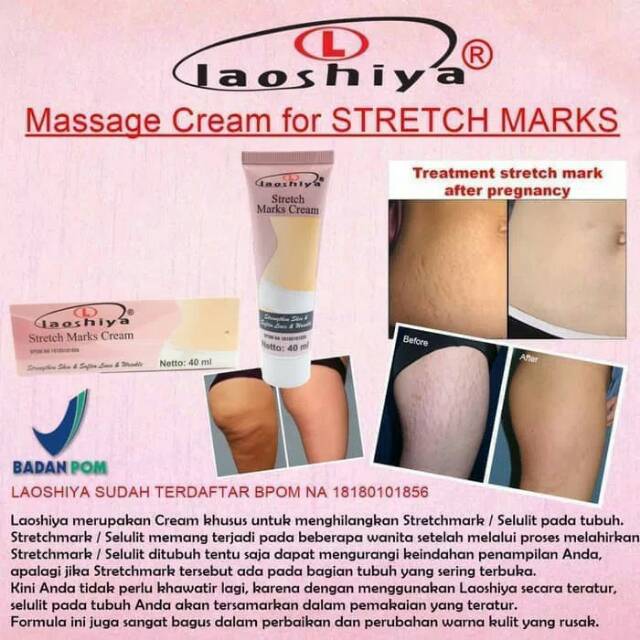 LAOSHIYA STRETCH MARKS CREAM BPOM - STRETCH MARKS LAOSHIYA ANTI SELULIT