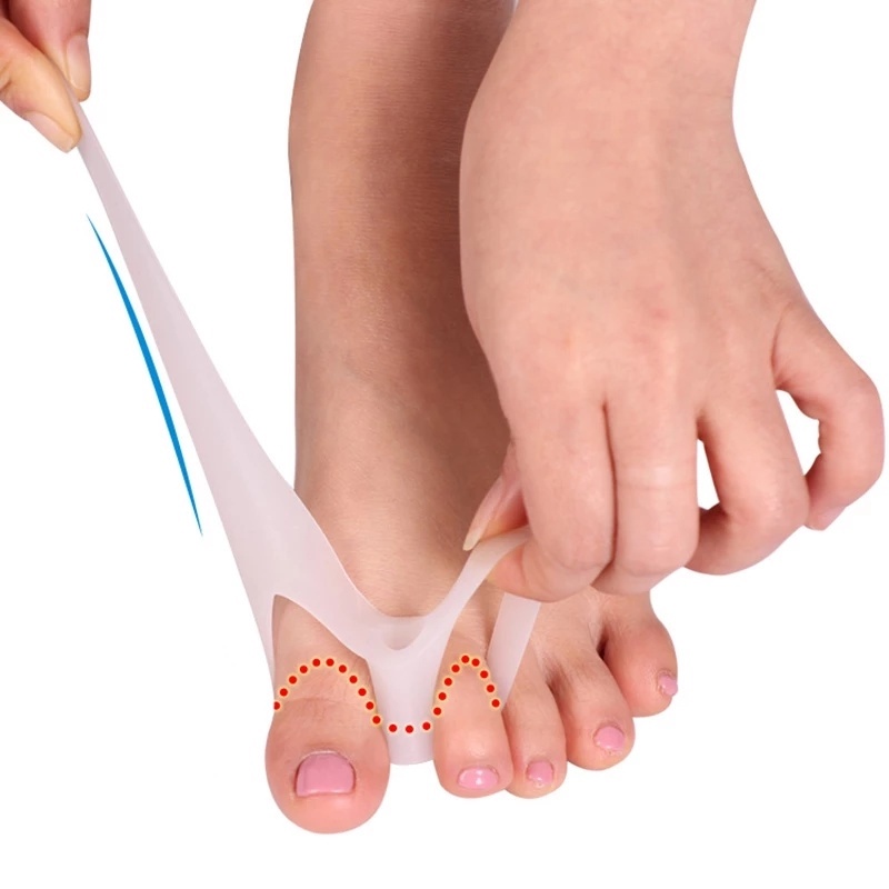 1 Pasang Bantalan Separator Jari Kaki Bahan Silikon Breathable Untuk Pereda Sakit / Korektor Bunion / Hallux Valgus