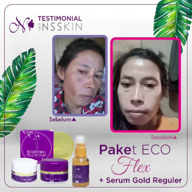 Paket flek New Nsskin