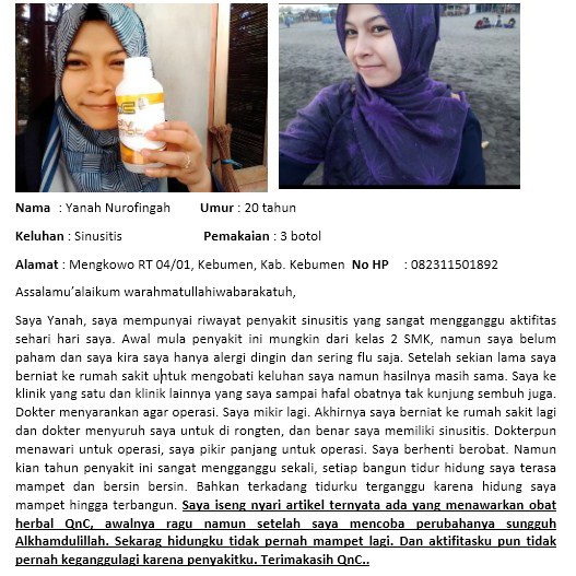 Obat Sinusitis, Hidung Tersumbat, Rhinitis, Flu Menahun, Radang Sinus, Polip Hidung, Flu, Pilek-8