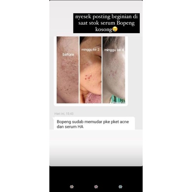 HA SERUM DAVIENA|SERUM BOPENG| DNA SALMON | DAVINA|DAVIENA SKINCARE|DAVIENA|SERUM HA DAVIENA