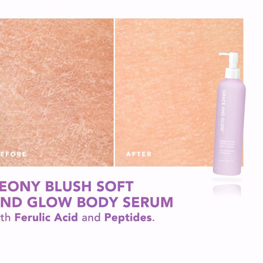 CL70↣ Grace and Glow Peony Blush Soft &amp; Glow solution Body Wash + Body Serum For Anti Blemish and Skin Barrier Ferulic Acid &amp; Peptides  ➘➺ Ready Stock