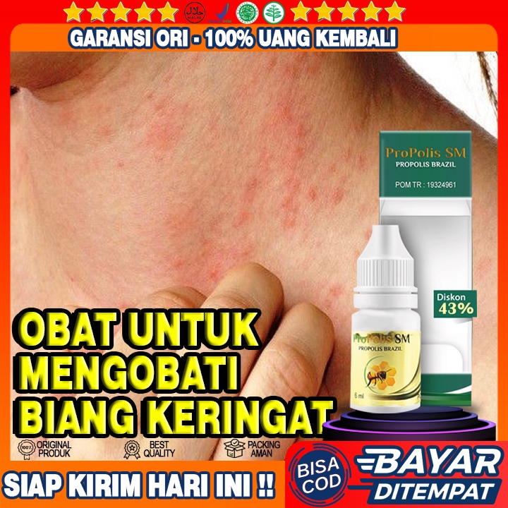 Obat Herbal Biang Keringat, Obat Infeksi Keringat, Obat Penghilang Gatal Biang Keringat, Propolis SM