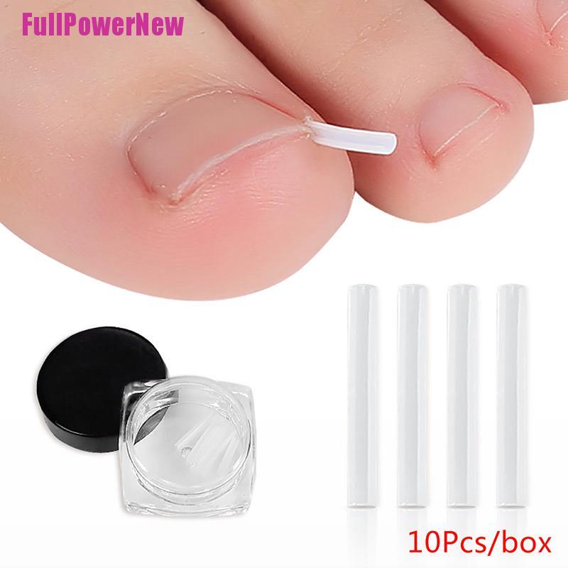 [Full] 10pcs Toenail Straightening Clip Ingrown Toenail Correction Nail Patch Sticker