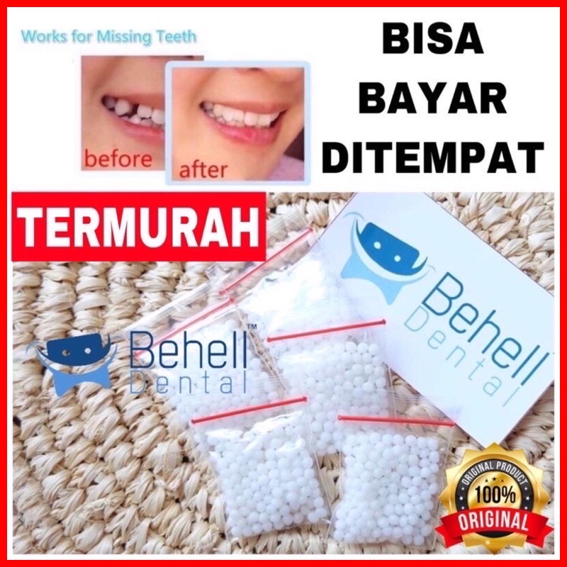 TERMURAH ! 600 BUTIR GIGI PALSU TEMPTOOTH PENAMBAL TAMBALAN GIGI PATAH RENGGANG TEMPORARY TOOTH TEMPTOOTH GINGSUL PATAH SEMENTARA - LEM GIGI TIRUAN DENTAL SOLID  ORTHO - 200 BUTIR / 100 BUTIR / 600 BUTIR - BEHELLDENTAL ORIGINAL