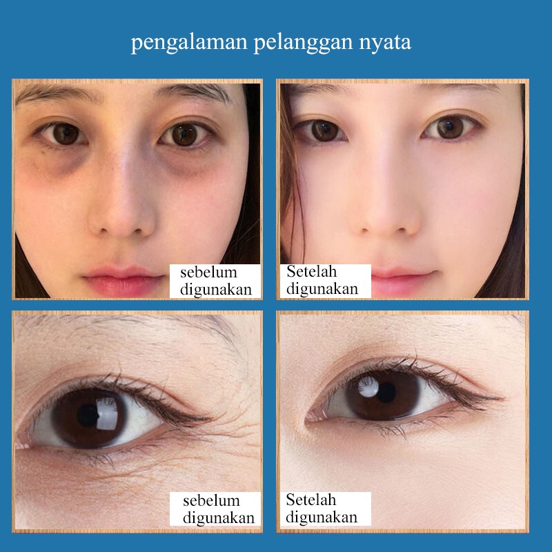 Eye cream 35g  eye cream somethinc mata panda serum Menghilangkan garis halus mata/butiran lemak/lingkaran hitam/kantung mata/tear trough eye cream skin Care Nourishing Panda Eye Treatment