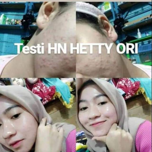 HN original jaminan uang kembali 100% ya say