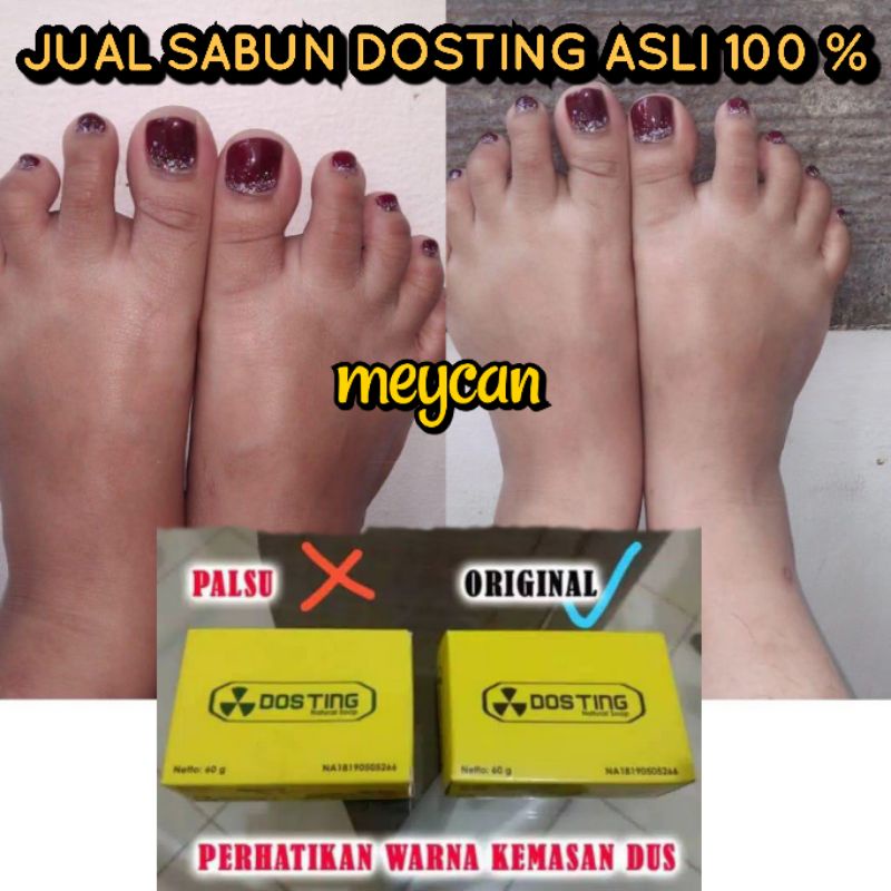 HANYA JUAL SABUN DOSTING KEMAS BOX ASLI BPOM