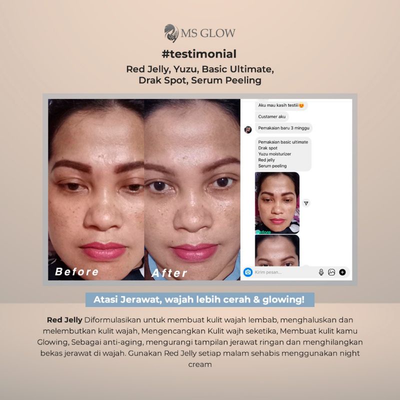 RED JELLY MS GLOW AMPUH UNTUK FLAWLESS GLOWING