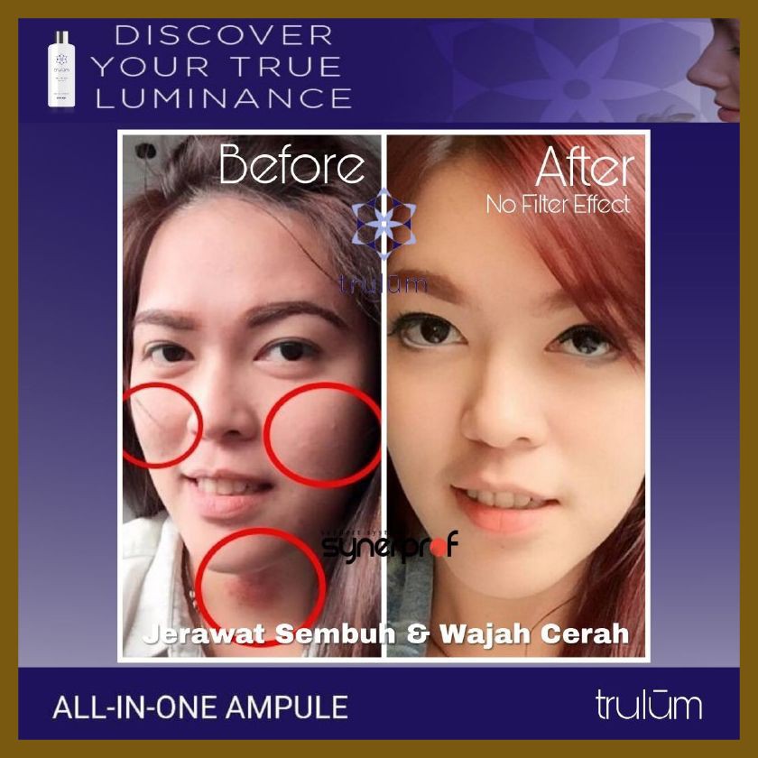 Pemutih Wajah BPOM Terbaik | Trulum Pemutih Wajah Paling Cepat & Aman